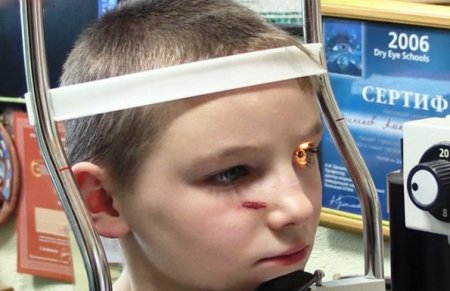 Российские врачи спасают зрение мальчику, раненному снарядом ВСУ