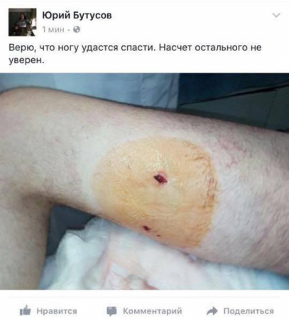 «Точно не выживет!»: Украинцы посмеялись над ранением депутата Дейдея (ФОТО)