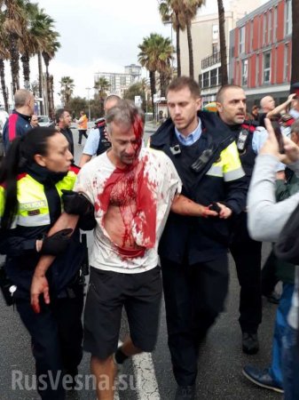 Бойня в Каталонии: Число пострадавших превысило 1000 человек (ВИДЕО, ФОТО 18+)