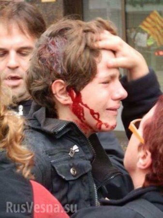 Бойня в Каталонии: Число пострадавших превысило 1000 человек (ВИДЕО, ФОТО 18+)