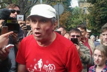 Зрада: второй избитый под посольством РФ заявил, что пришел поддержать жену проголосовать против Путина (ФОТО)