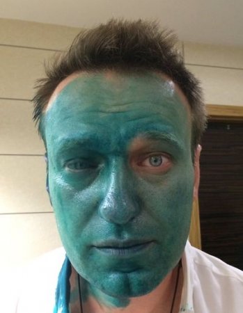 Навальный и Бабченко: Зелёный марш «людей первого сорта» (ФОТО, ВИДЕО)