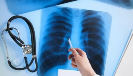 Роспотребнадзор: Туберкулез на Украине продолжает распространяться