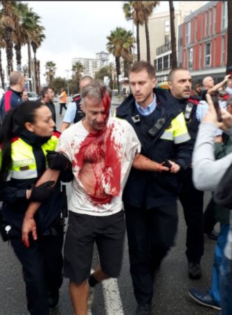 Десятки пострадавших в Каталонии: в соцсетях показали фото избитых