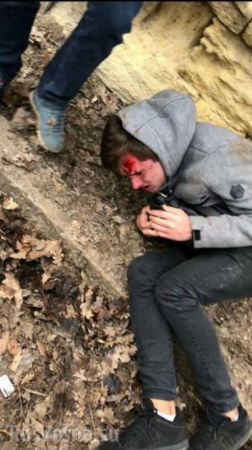 Неонацисты жестоко избили участника возложения цветов к памятнику Героям-Ольшанцам в Николаеве (ФОТО)