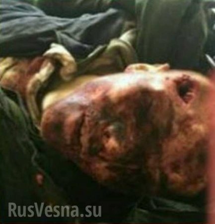 Шокирующие кадры: Захваченный в плен ВСУ боец ДНР умер от пыток (ФОТО, ВИДЕО строго 18+)