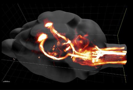 Ученые придумали, как «заставить» мозг вылечить паралич после перелома позвоночника