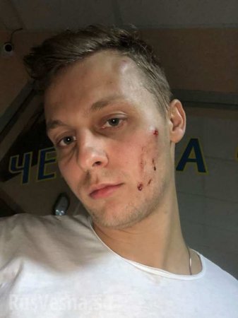 В киевском ресторане избили сына оппозиционного депутата (ФОТО)