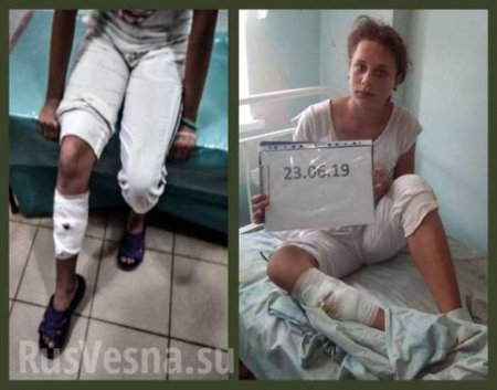 Обстрелом ВСУ в Горловке ранена девочка — подробности (ФОТО, ВИДЕО)