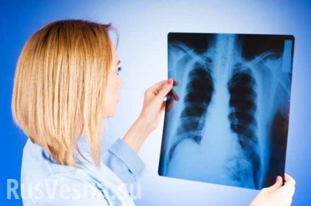 Названы ранние симптомы рака лёгких: чего опасаться
