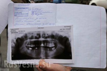 «В следующий раз убьют»: под Одессой выбили зубы «всушнице», обвинившей командование в воровстве (ФОТО, ВИДЕО)