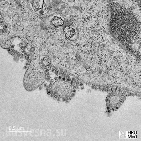 Опубликованы первые снимки размножения коронавируса (ФОТО)