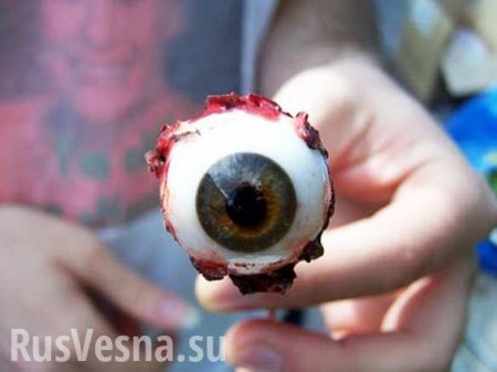 Армянин выбил глаз украинцу в Варшаве (ФОТО)