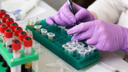 Нидерландская компания продала 1,5 млн некачественных тестов на коронавирус