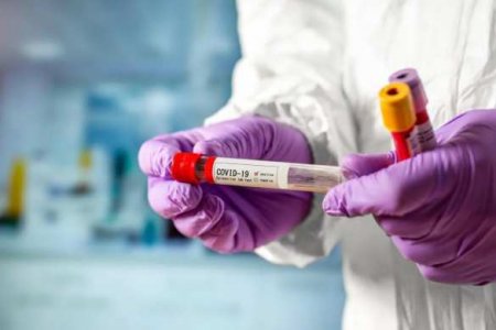 Собянин объявил о начале программы массового тестирования на коронавирус