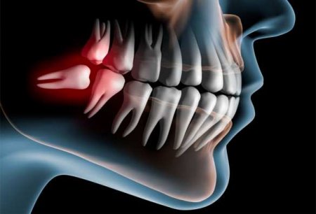 Проблемы с зубами наносят серьёзный удар по здоровью