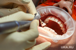 Стоматолог рассказал об осложнении, навсегда меняющем цвет зубов
