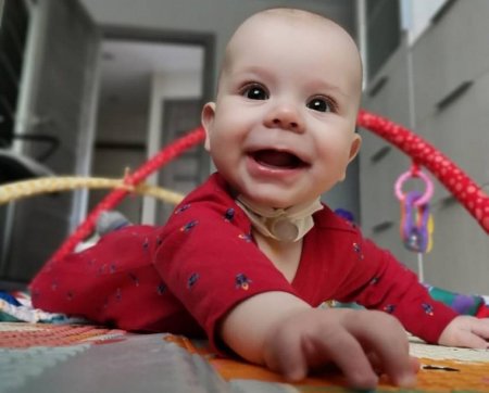 В Свердловской области ребенок два года живет с трубкой в горле